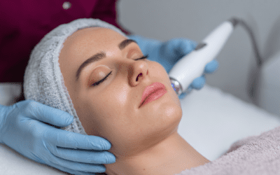 Collagen Induction Facials for Fine Lines